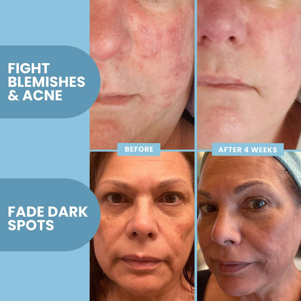 Eva Naturals Vitamin C Serum on skin during application for an even complexion