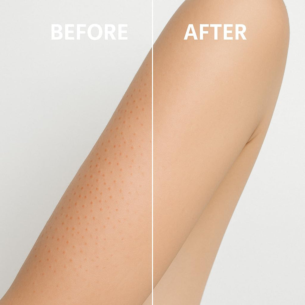 EVERCLEARNOW KP bumps scrub calms keratosis pilaris with gentle exfoliation