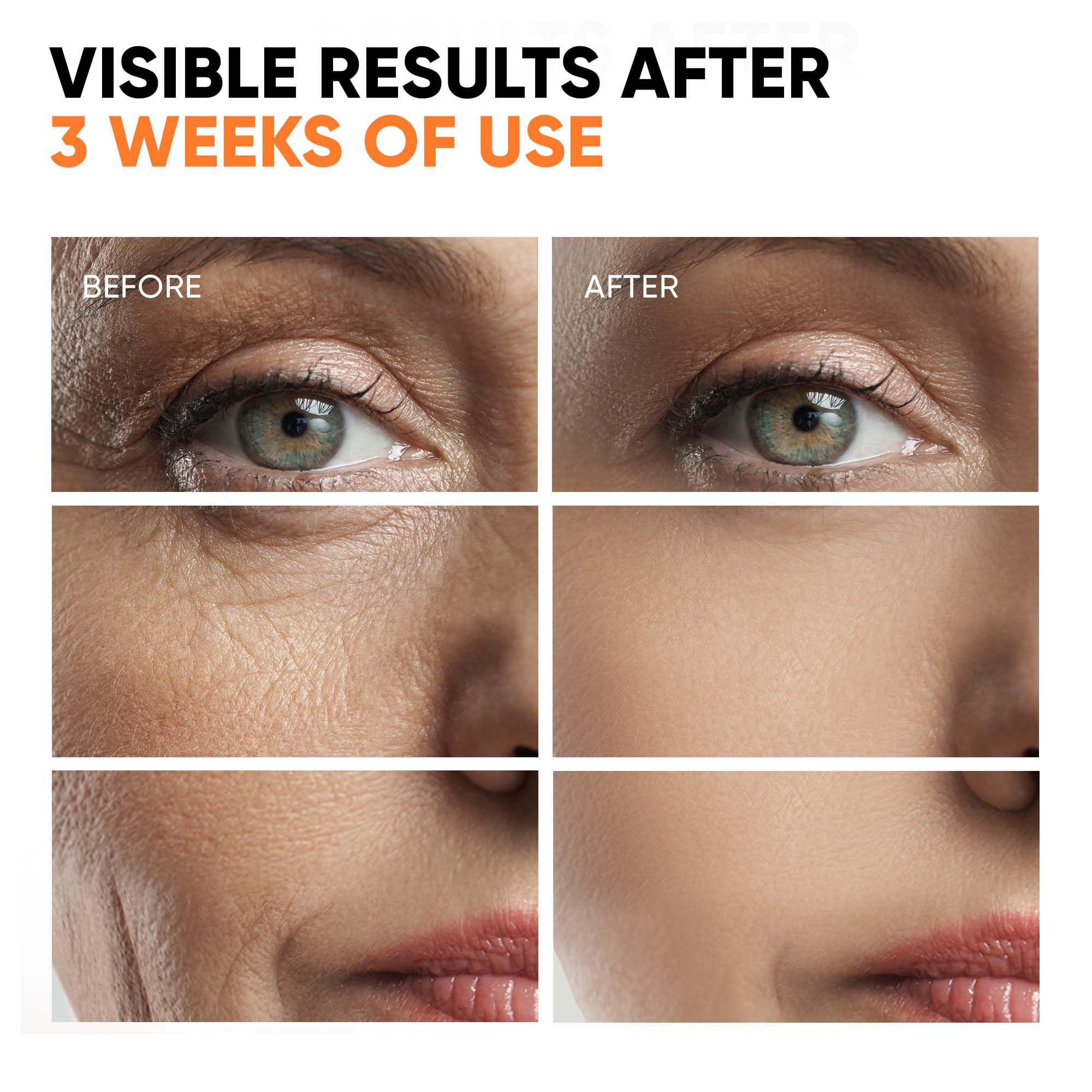 EVERYOUTH close-up of vitamin E-rich serum for nourishing antioxidant protection.