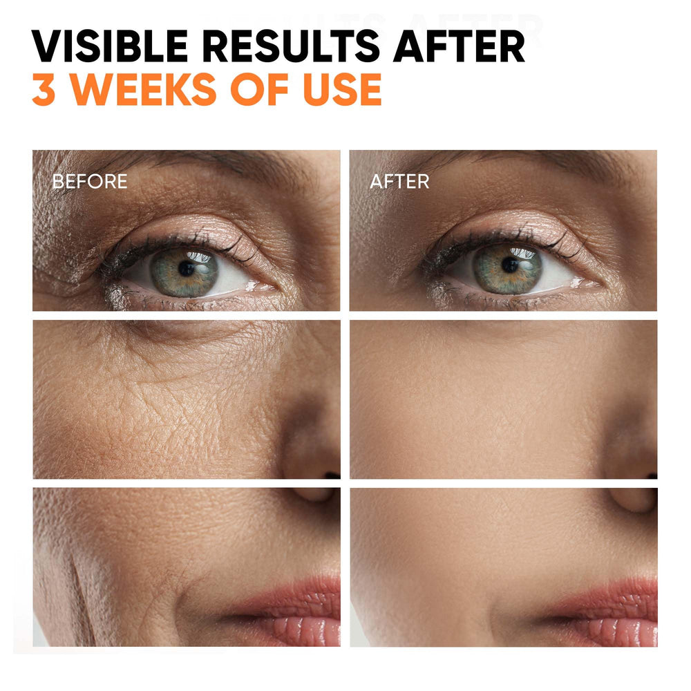 EVERYOUTH close-up of vitamin E-rich serum for nourishing antioxidant protection.