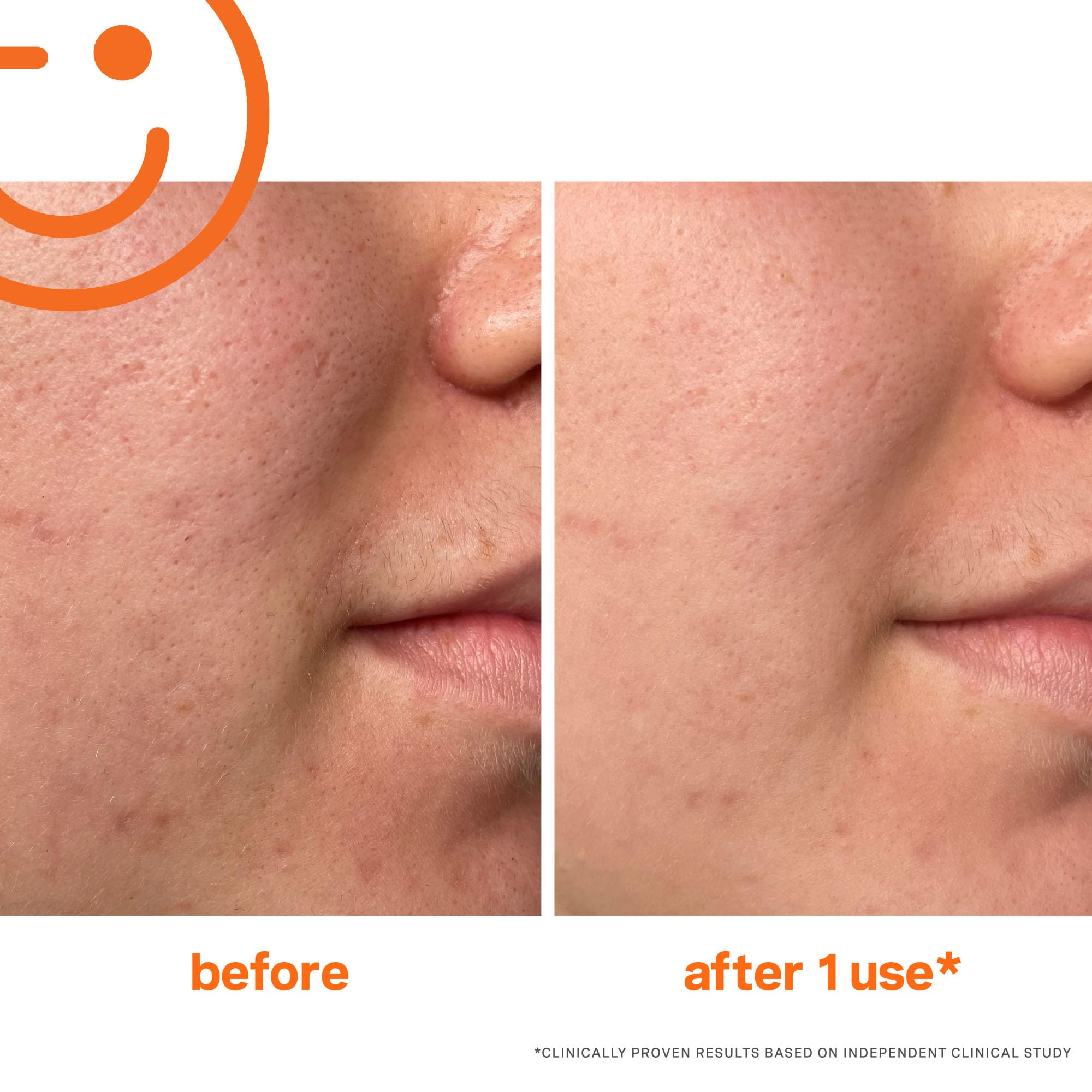 Exfolikate face application visual with massaging motion for smoother skin texture.