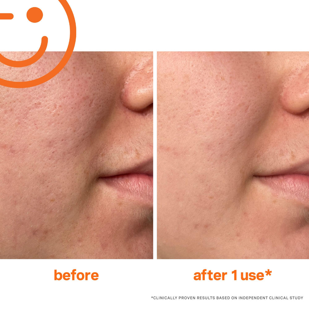 Exfolikate face application visual with massaging motion for smoother skin texture.