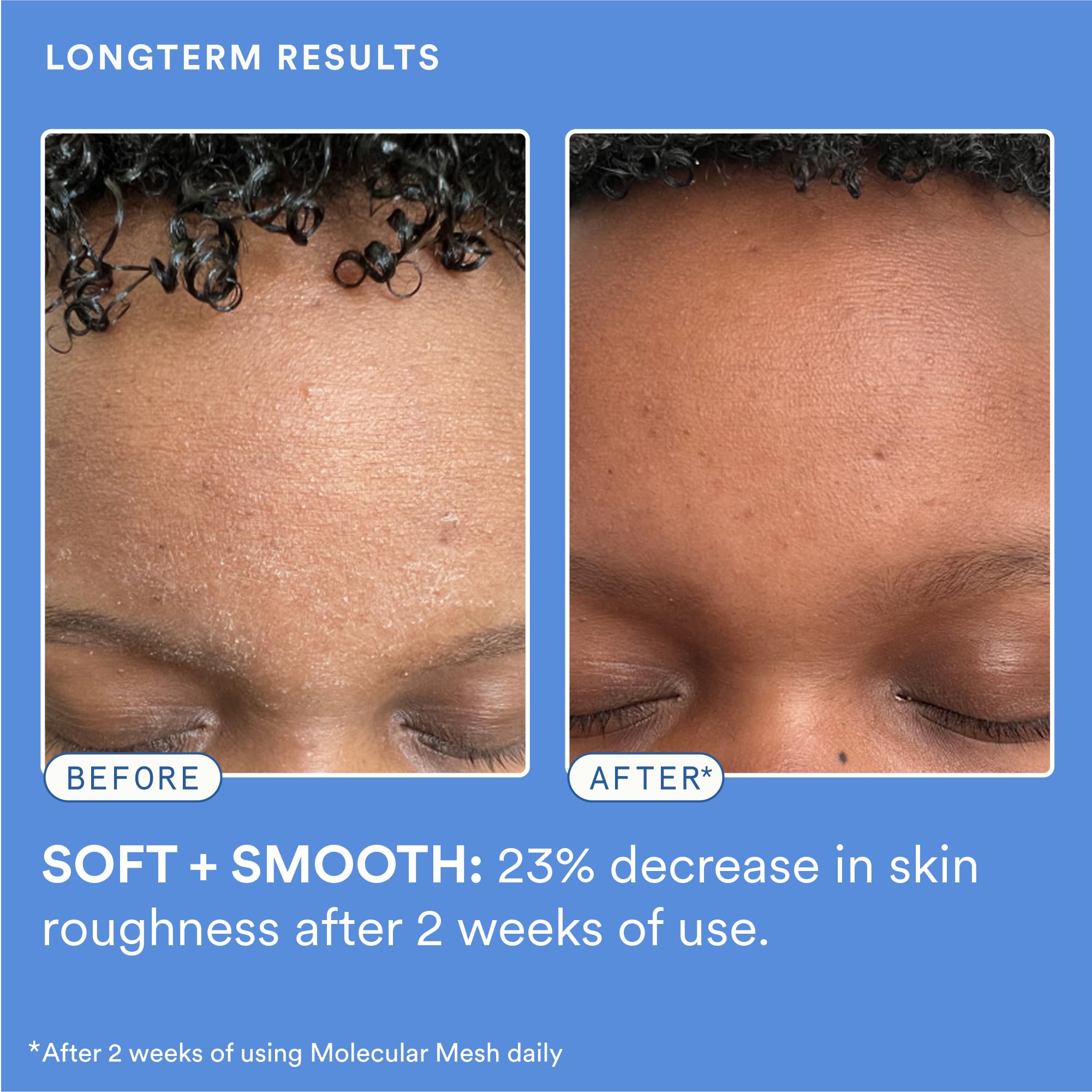Experiment Molecular Mesh Barrier Repair ectoin ingredient highlight for calming renewal.
