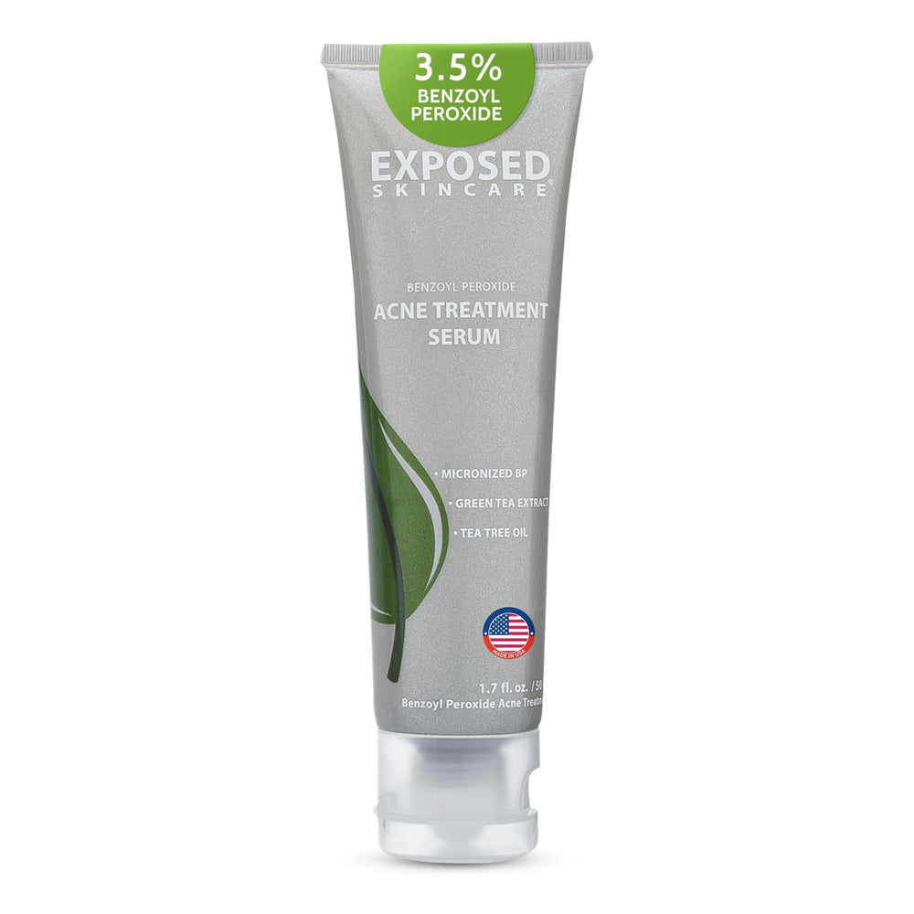 Exposed Skin Care acne serum bottle closeup with targeted spot treatment.