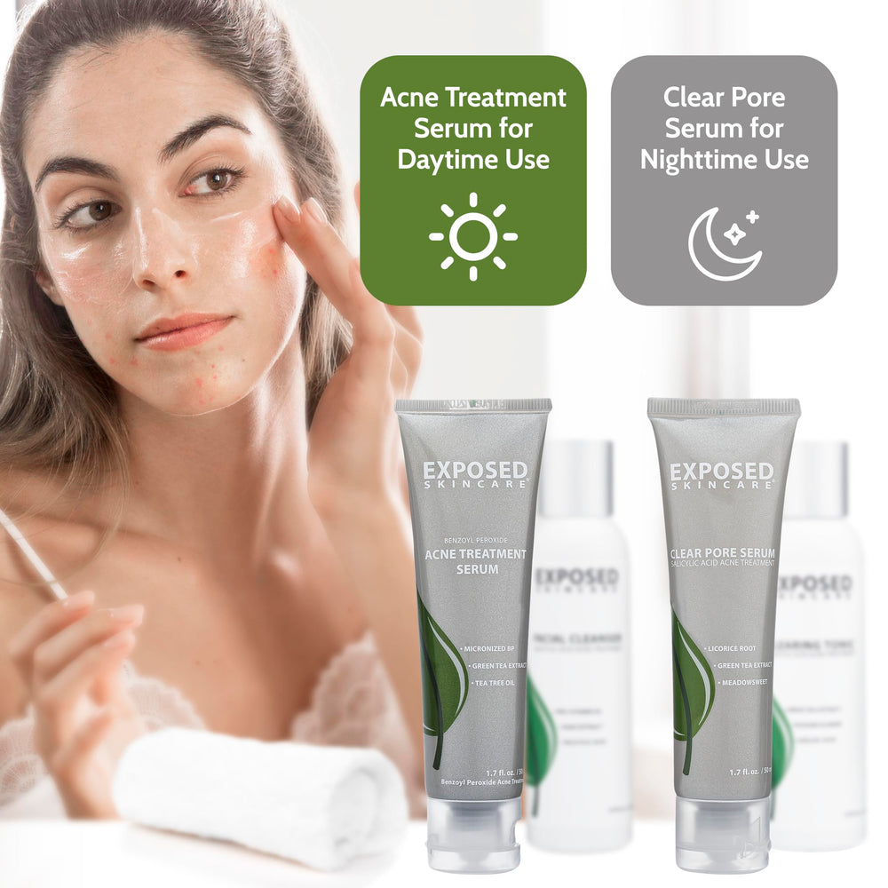 Exposed Skin Care basic acne kit back label detail for ingredient transparency.
