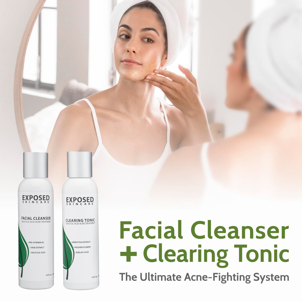 Exposed Skin Care basic acne kit arrangement for daytime skincare routine.