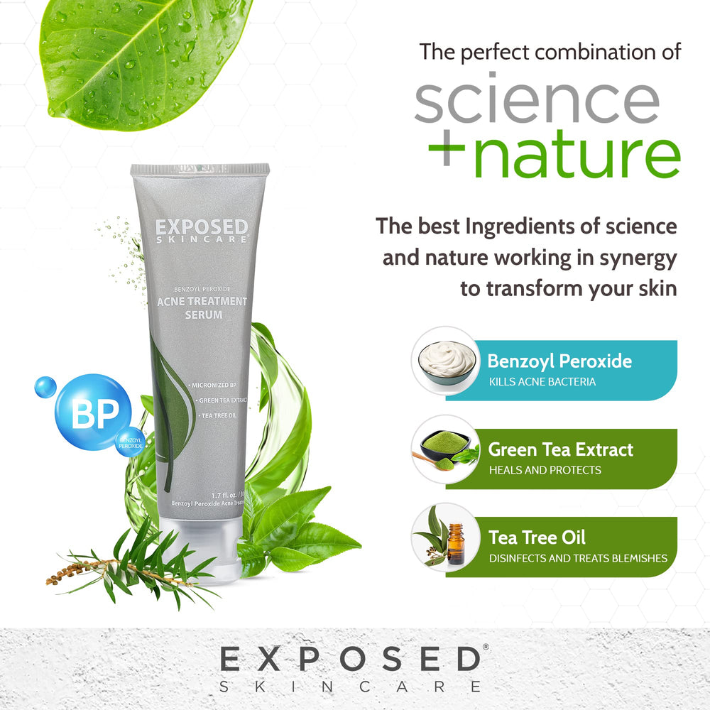 Exposed Skin Care micro benzoyl peroxide illustration for blemish-fighting formula.