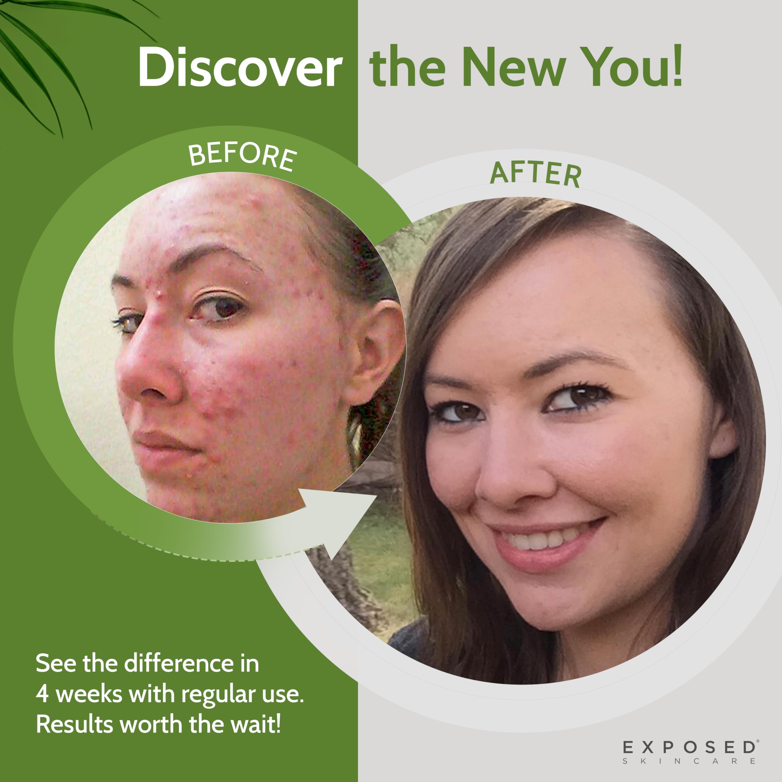 Exposed Skin Care witch hazel toner ingredients highlight calming properties.