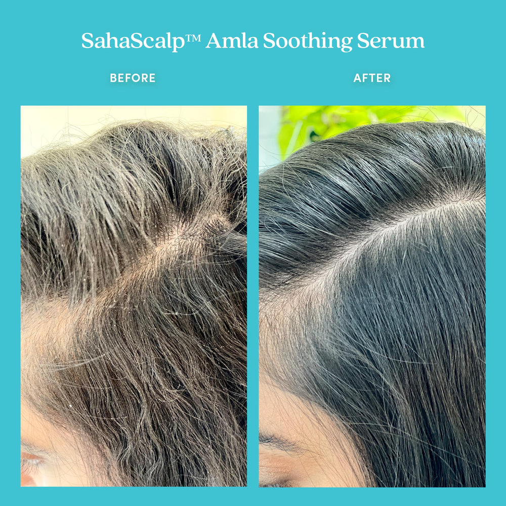 Fable & Mane pre-wash scalp oil pour highlights lightweight, non-greasy texture
