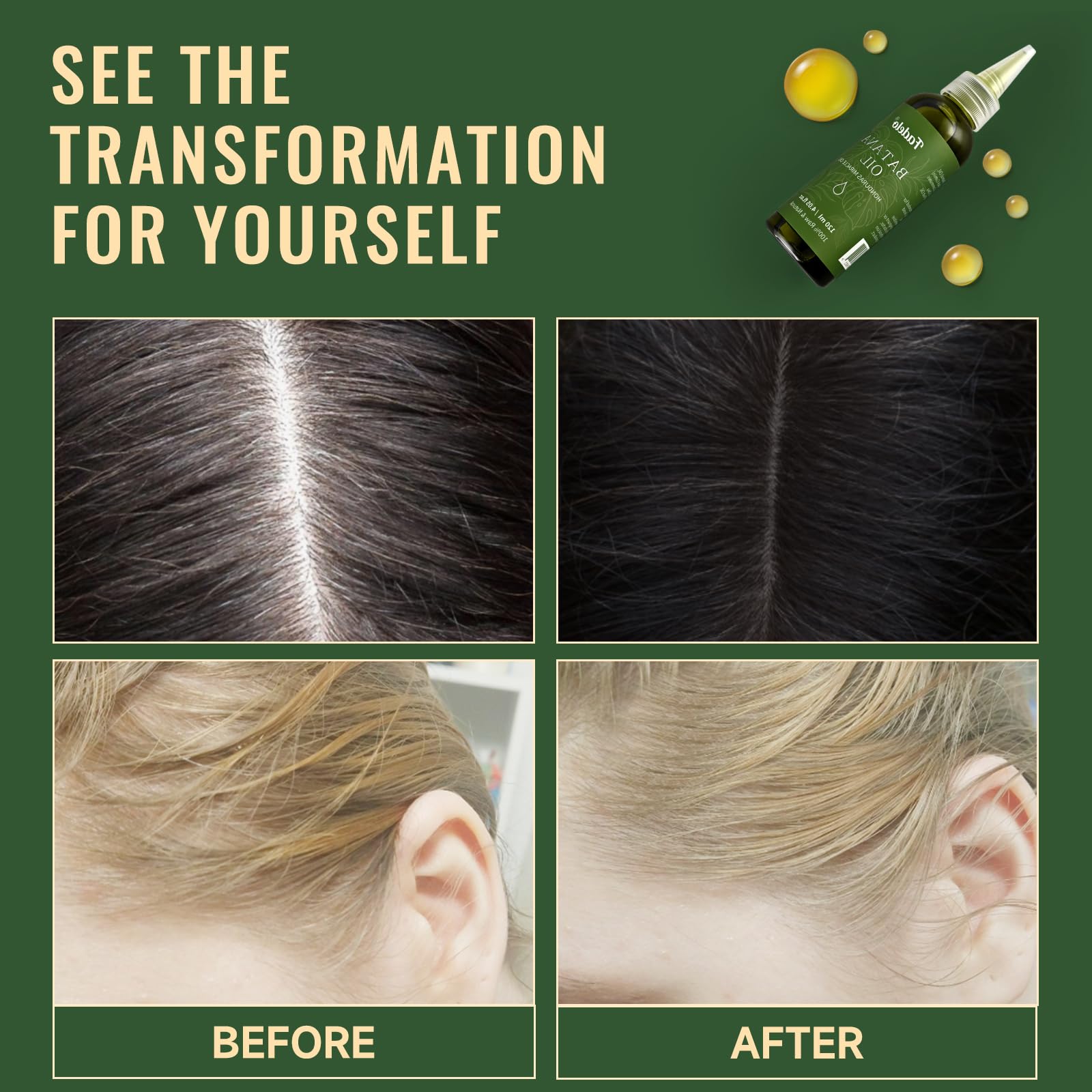 Fadelo Batana Oil seeds image highlights Honduras-sourced nutrients for hair growth.