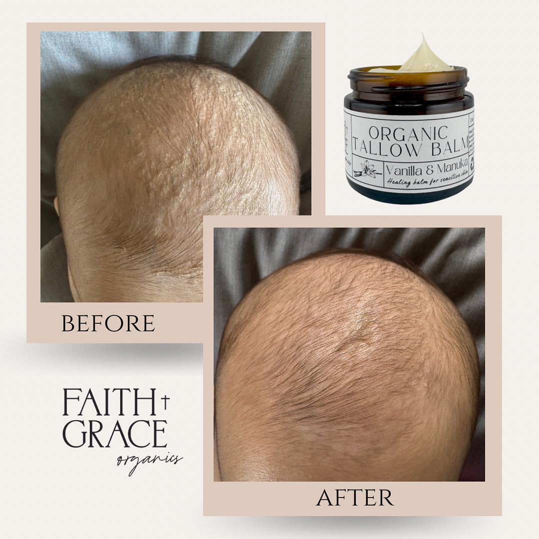 Faith and Grace Organics Baby Skin Care Balm gentle enough for delicate skin.