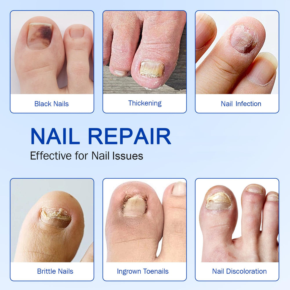 FANSHI hydrogel patches cushion nails during wear and release moisture