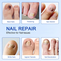 FANSHI hydrogel patches cushion nails during wear and release moisture
