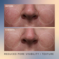 Farmacy Face Exfoliator Serum Honey Glow applying dropper captures night-time routine