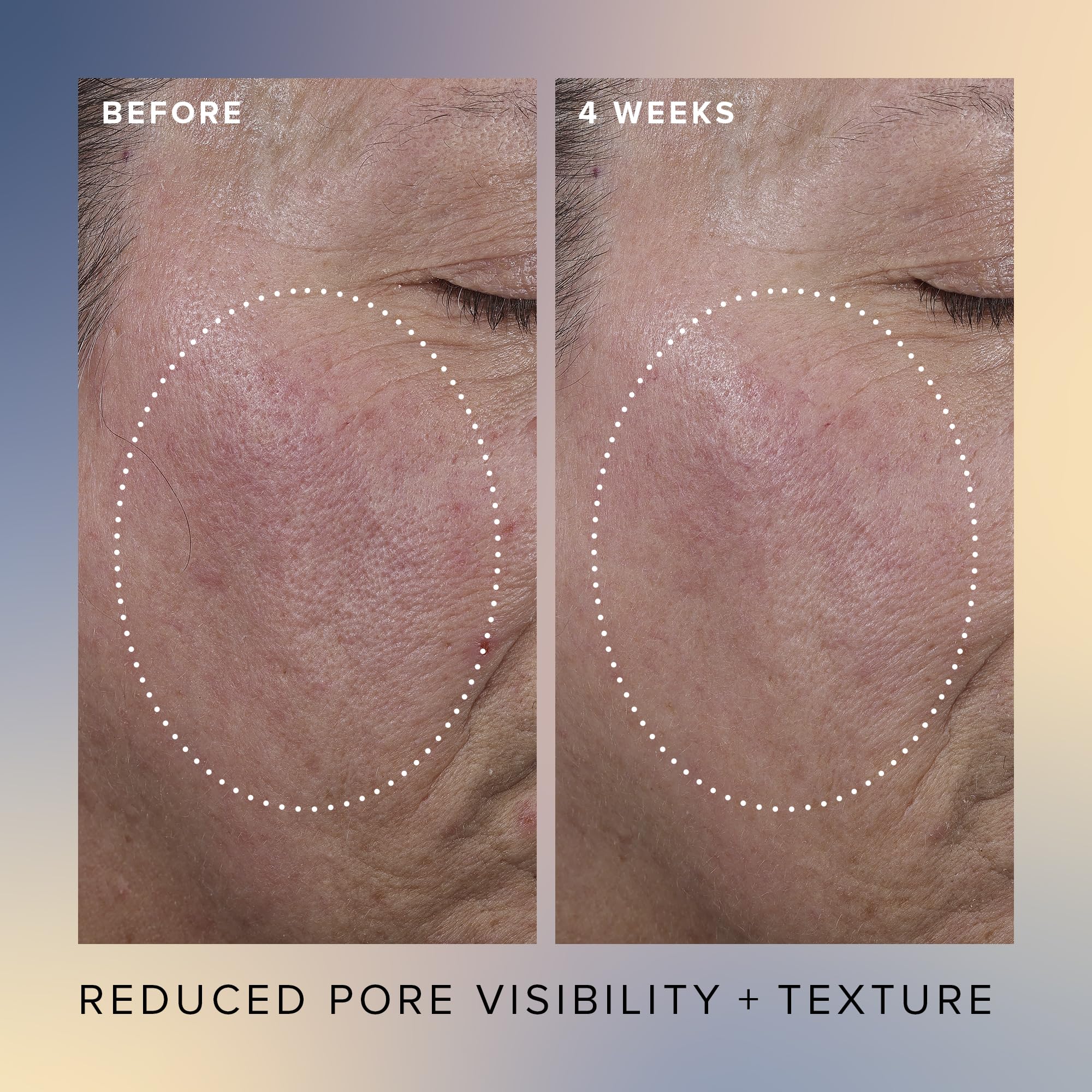 Farmacy Face Exfoliator Serum Honey Glow texture closeup reveals silky consistency