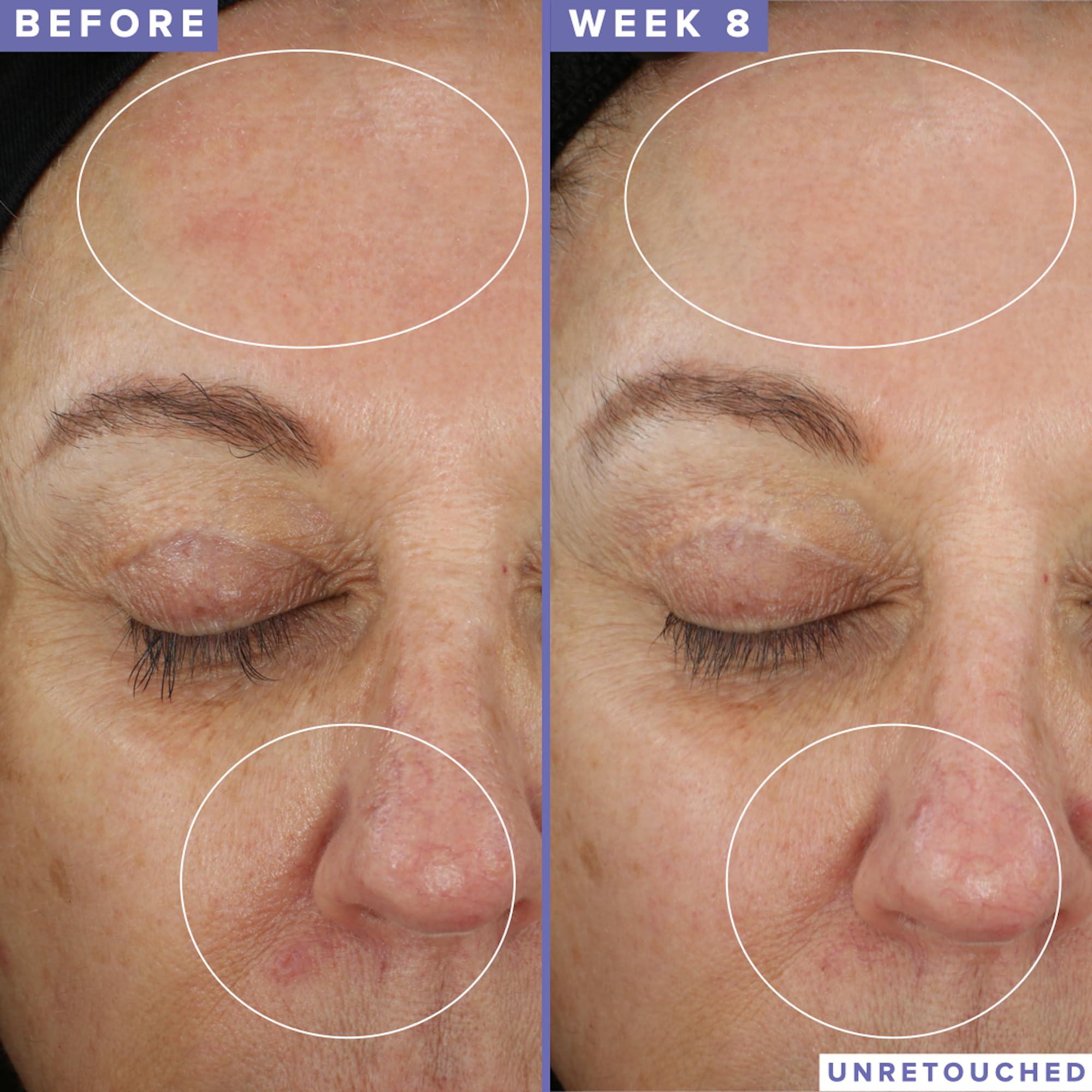 Blueberry seed oil in Farmacy Niacinamide Overnight Mask supports glow
