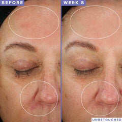 Blueberry seed oil in Farmacy Niacinamide Overnight Mask supports glow