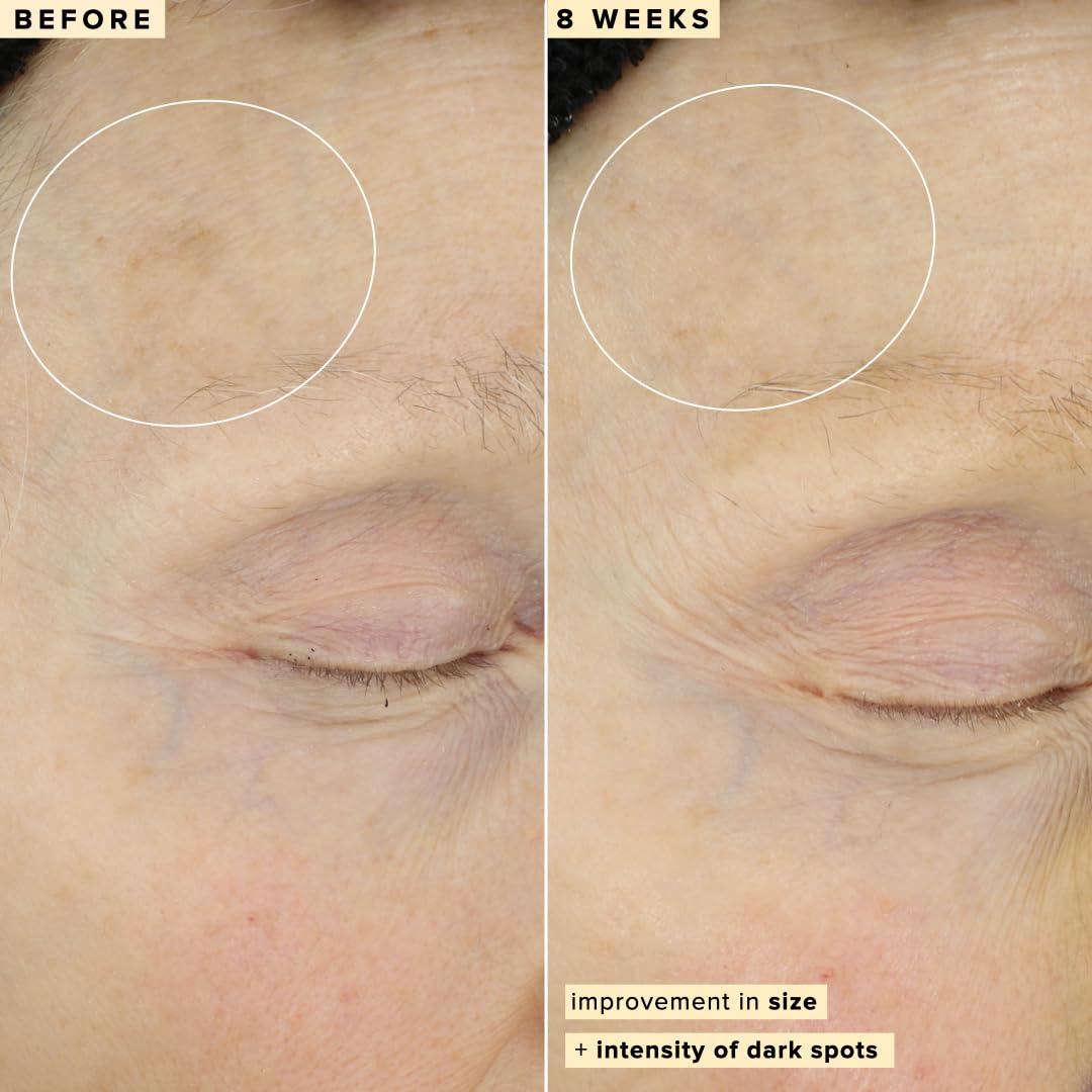 AM application of Farmacy serum on clean skin.