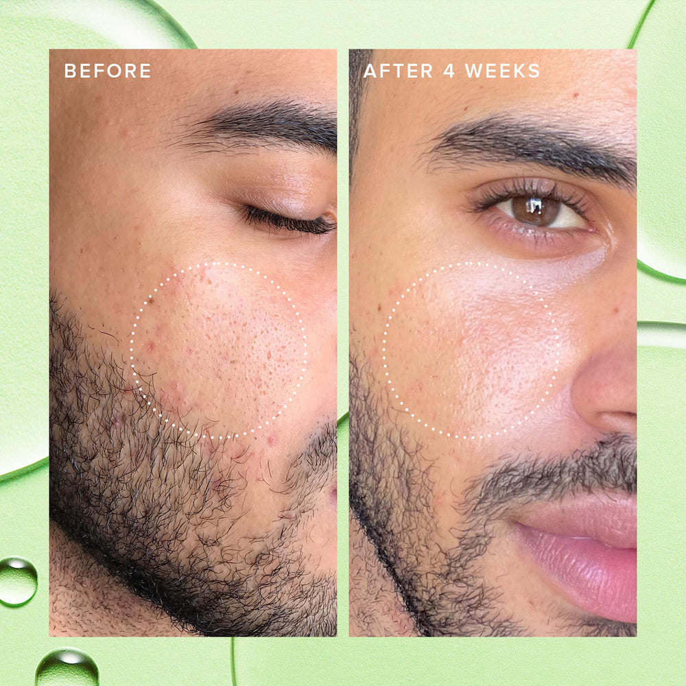 Farmacy 2% Toner moringa water close-up showing soothing balance.
