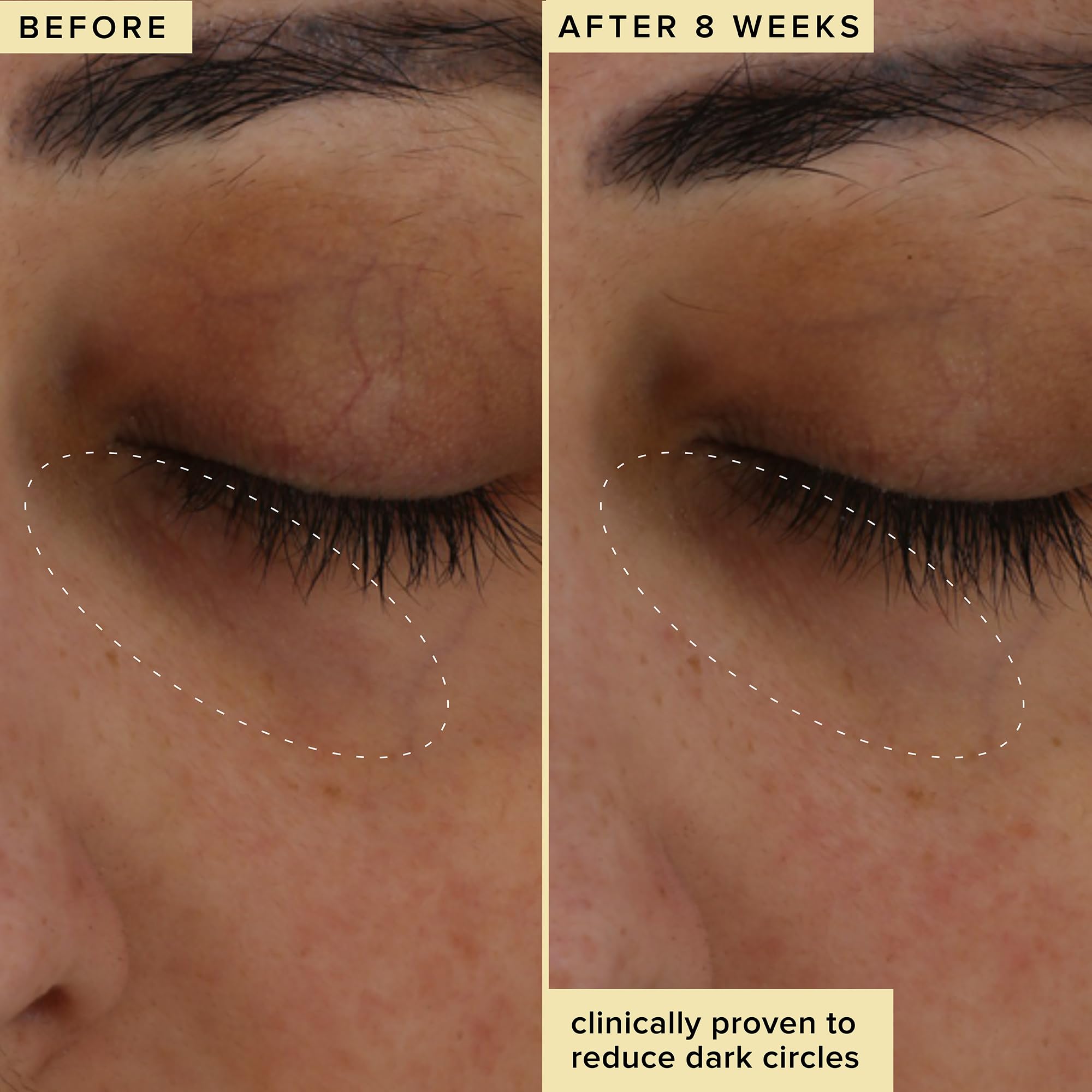 Cranberry peptide and encapsulated caffeine target crow's feet over time.