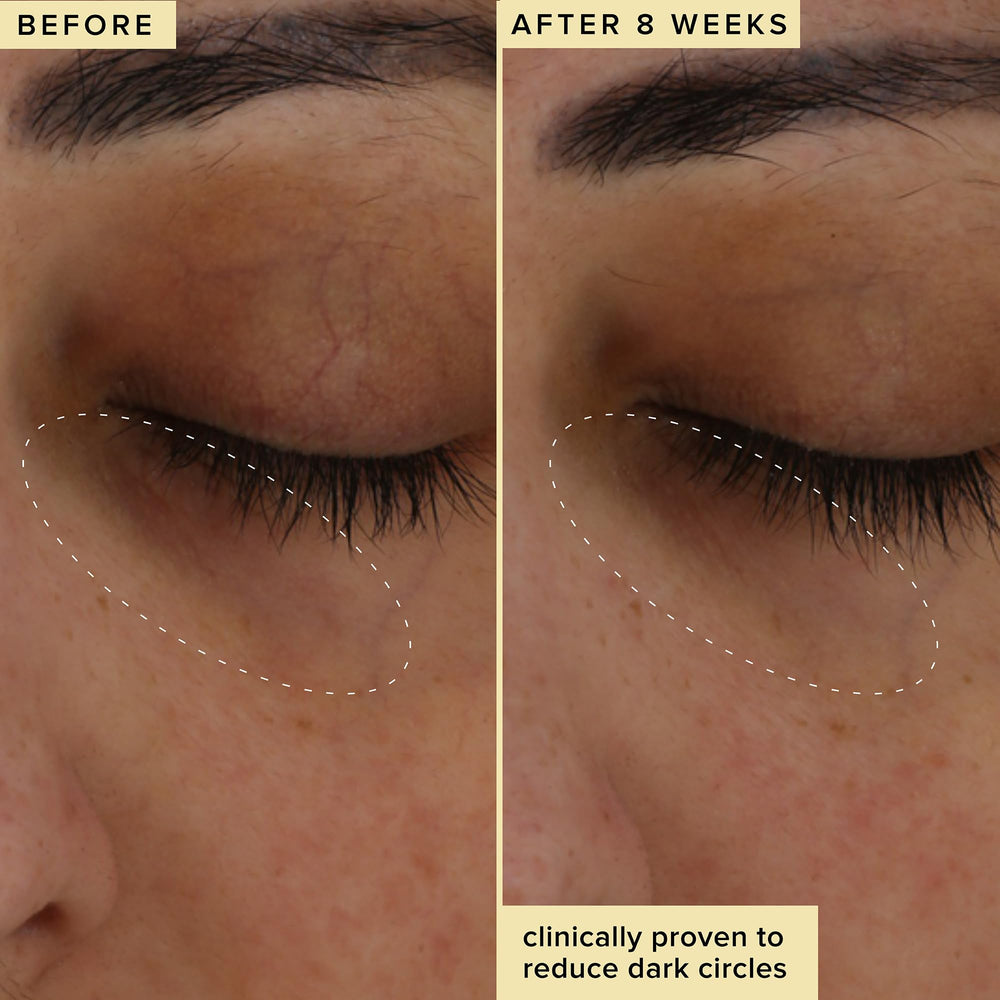 Cranberry peptide and encapsulated caffeine target crow's feet over time.
