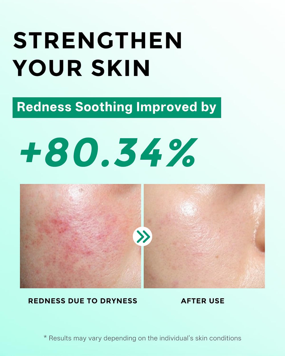 FeeMeFee Azelaic Serum application routine visual suggests simple daily use