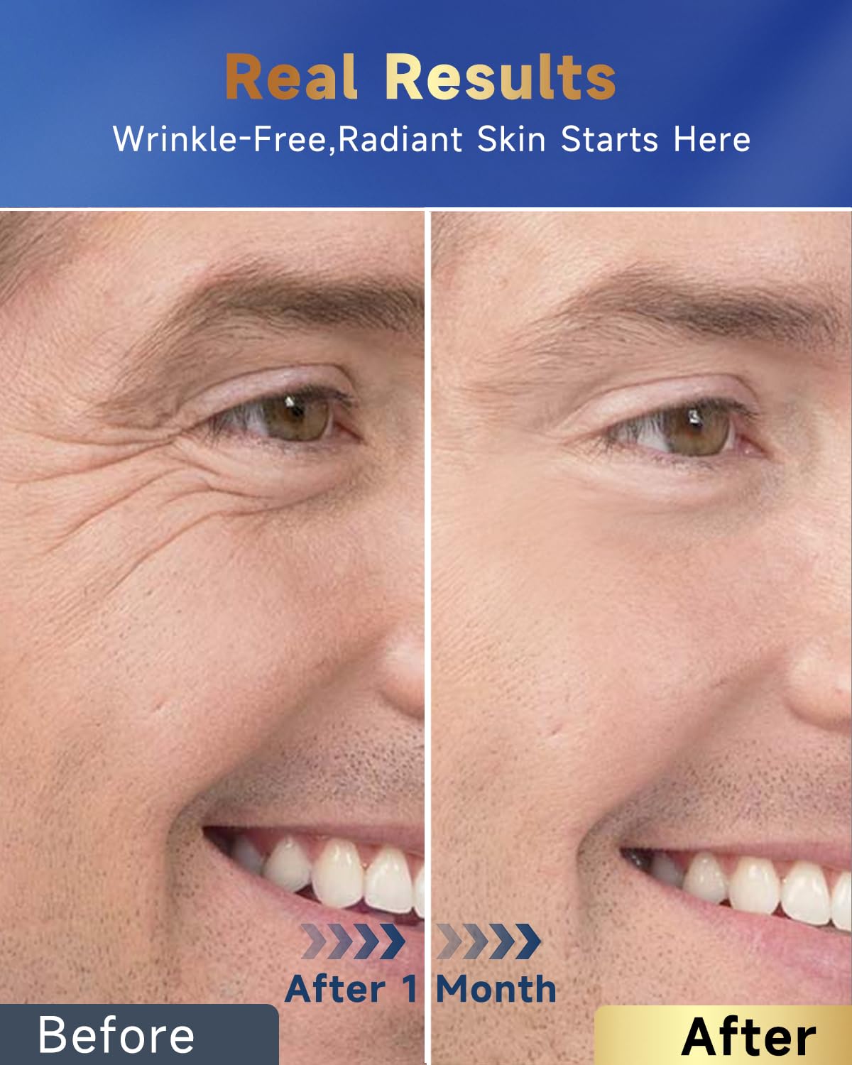 Felicemy 6-in-1 post-shave care visual for soothing irritation.