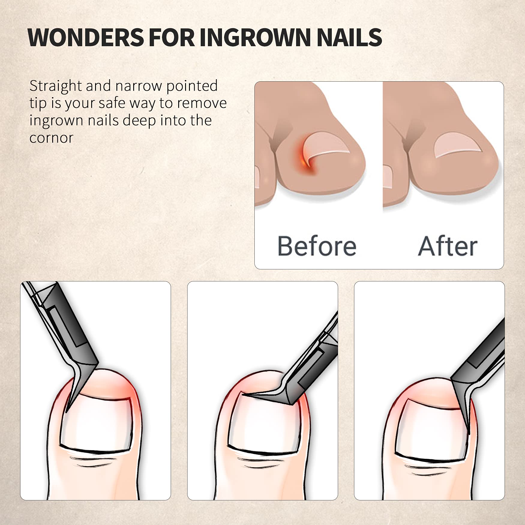 FERYES clipper 120° slant aids easier trimming of thick nails