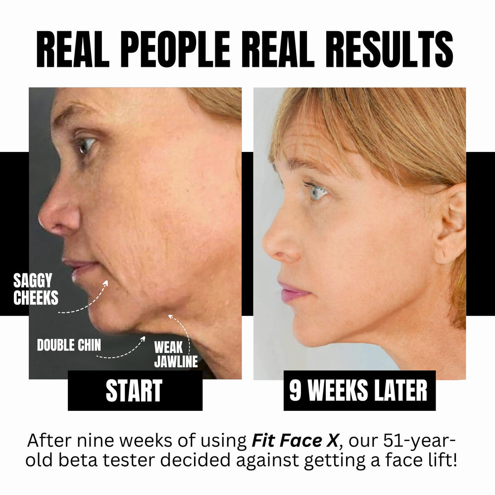 FFX Cheek X firms cheeks and tightens jowls for a more contoured look.