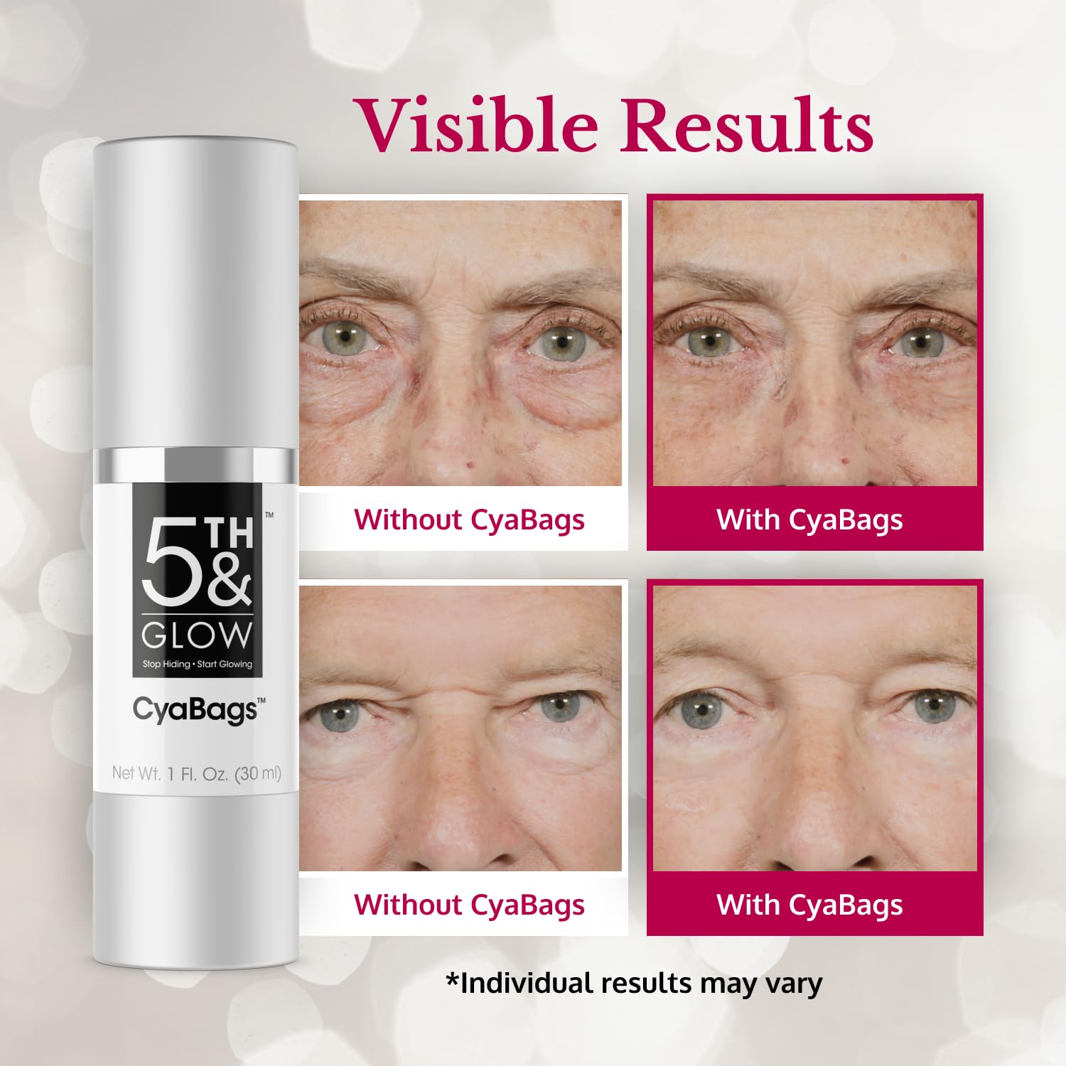 Cyabags under-eye area application demonstrating smooth lift