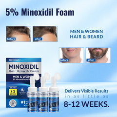 Figtorus Minoxidil Foam pump dispensing onto fingertips for precise application