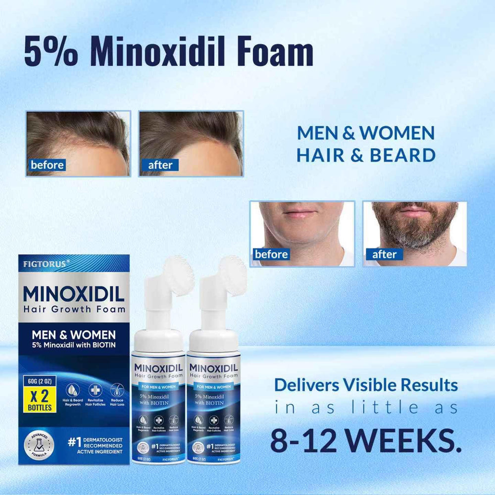 FIGTORUS Minoxidil Foam tube close-up emphasizing rich foam texture and quick absorption.