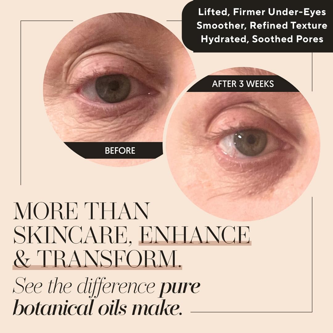 Finally Under-Eye Serum application shows gentle brightening for dark circles.
