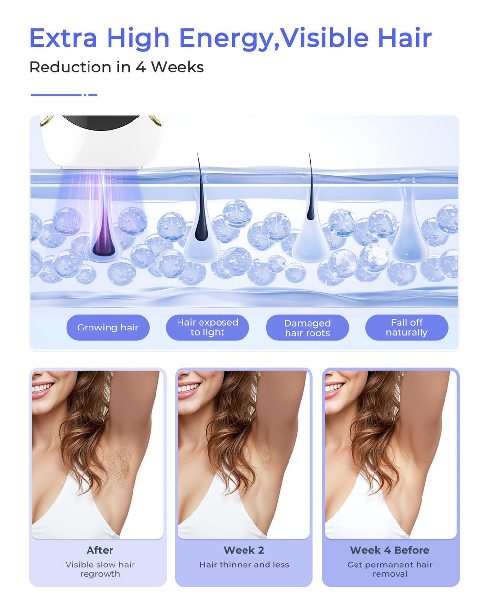 Finequin Air 15 auto-glide mode enables faster hair removal across large areas.