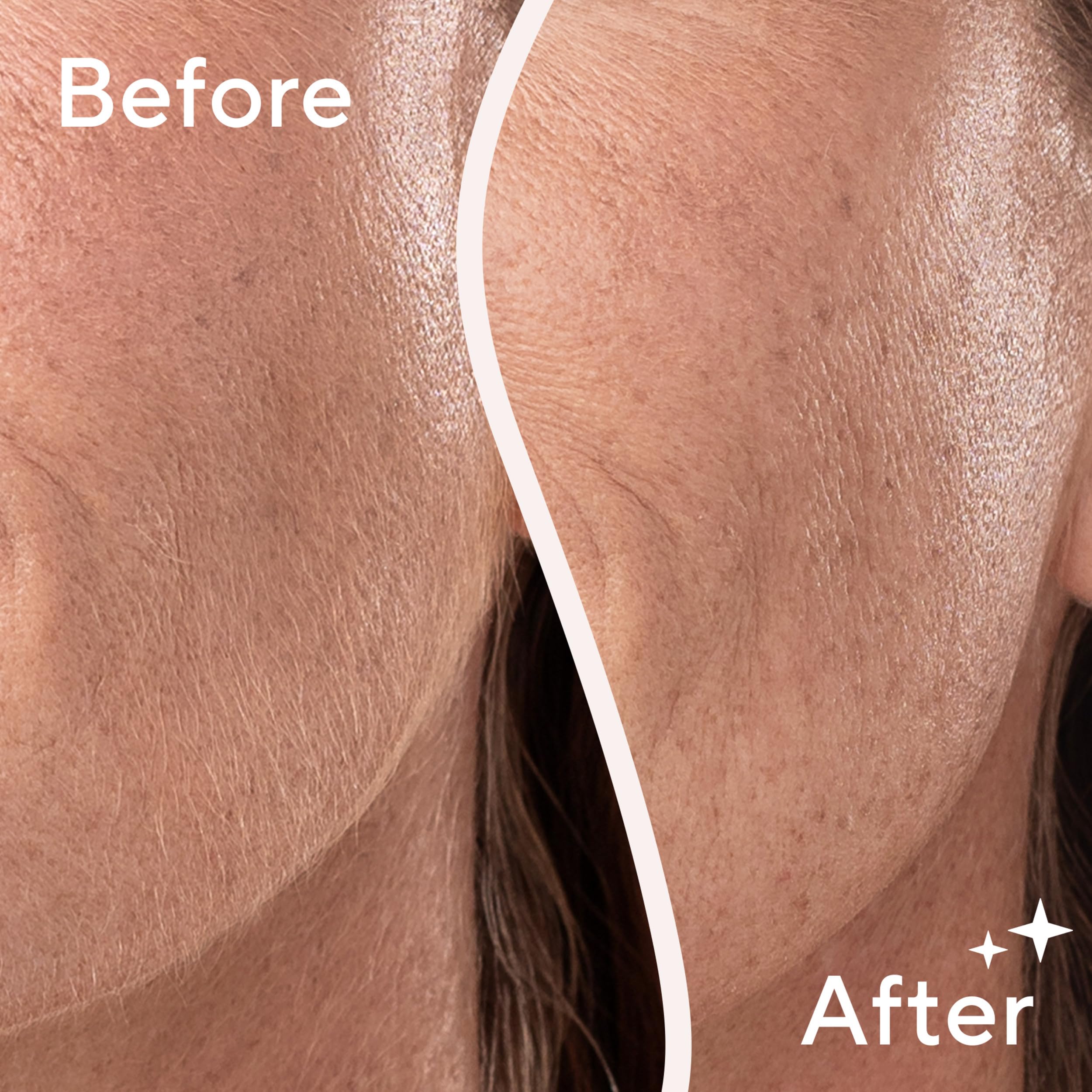 Finishing Touch Flawless Dermaplane Glo Sonic battery included for ready setup.