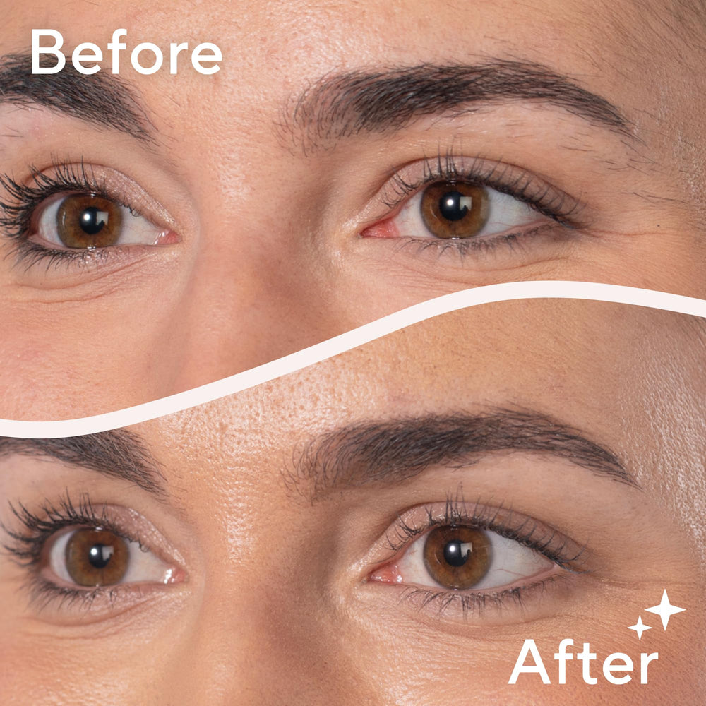 Finishing Touch Flawless Stray Hair Remover dermatologist-approved design for all skin types.