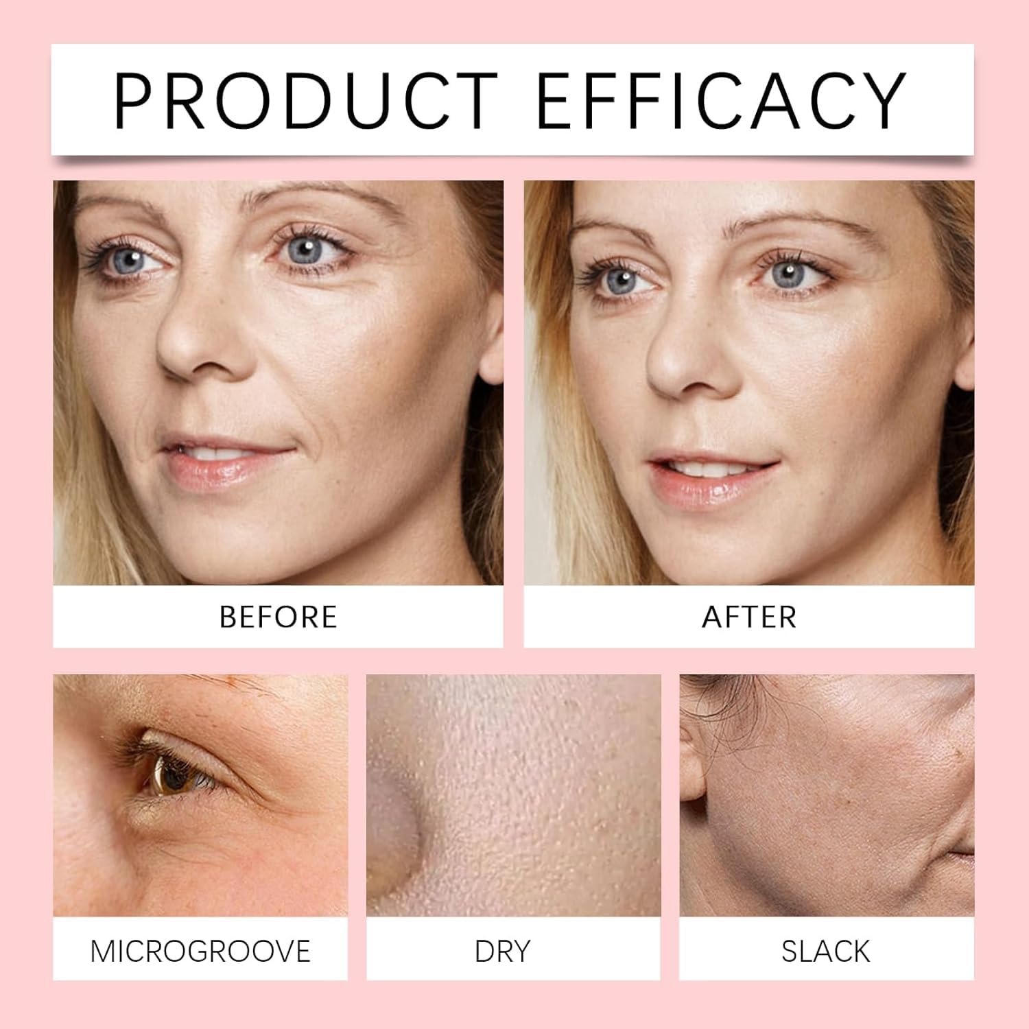 Finones Serum with vitamin C and niacinamide targets tone and texture