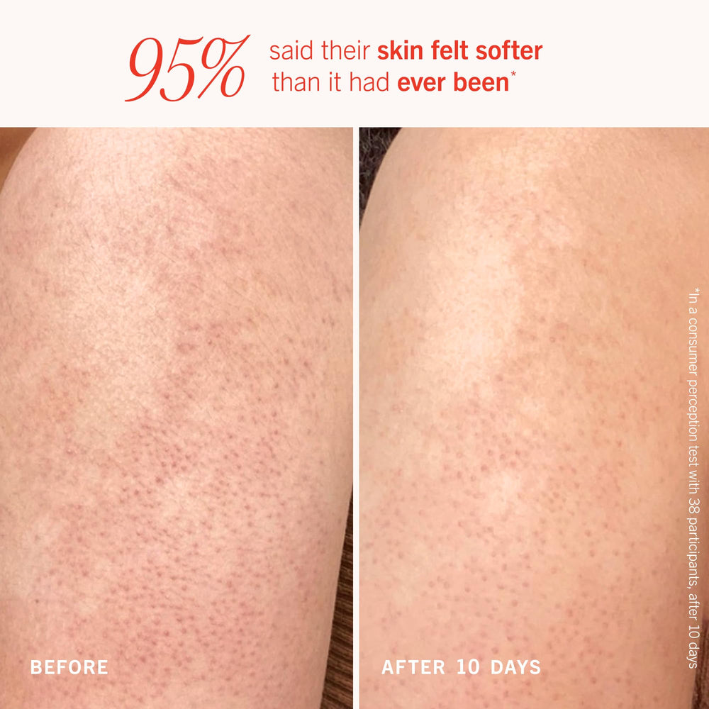 Glycolic and lactic acids 10% AHA exfoliation detail with beads