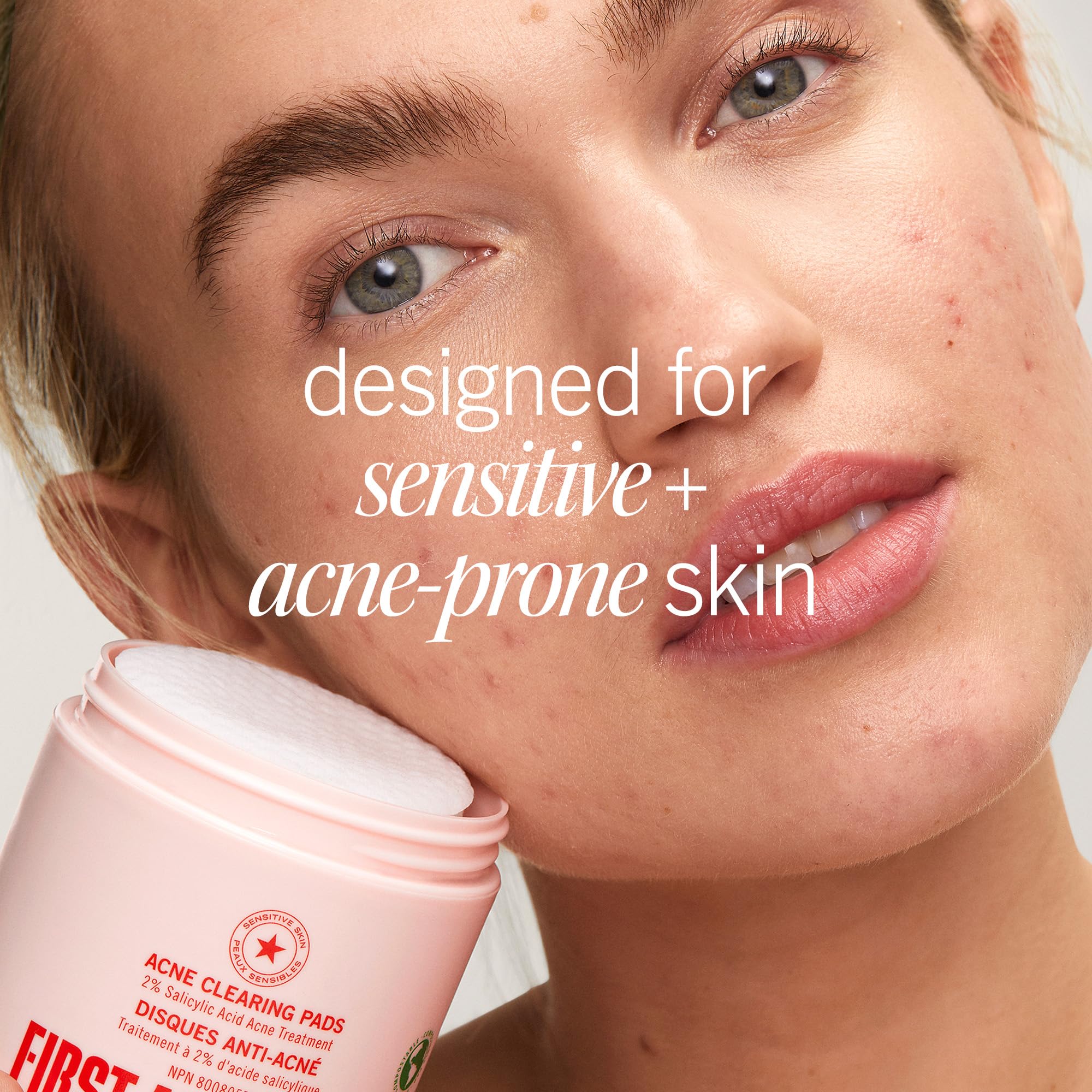 First Aid Beauty acne pads skin texture improvement after use
