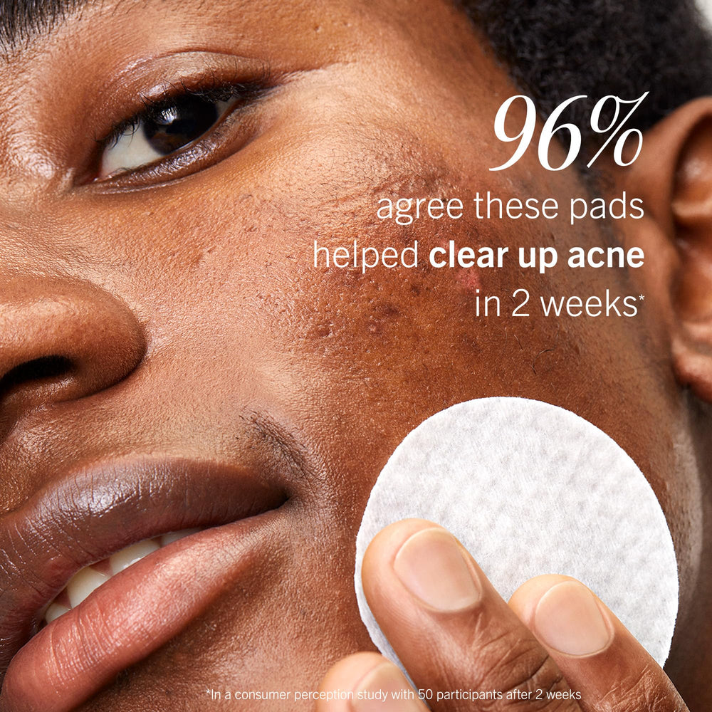 First Aid Beauty acne pads two-week results concept highlighting perceived clarity