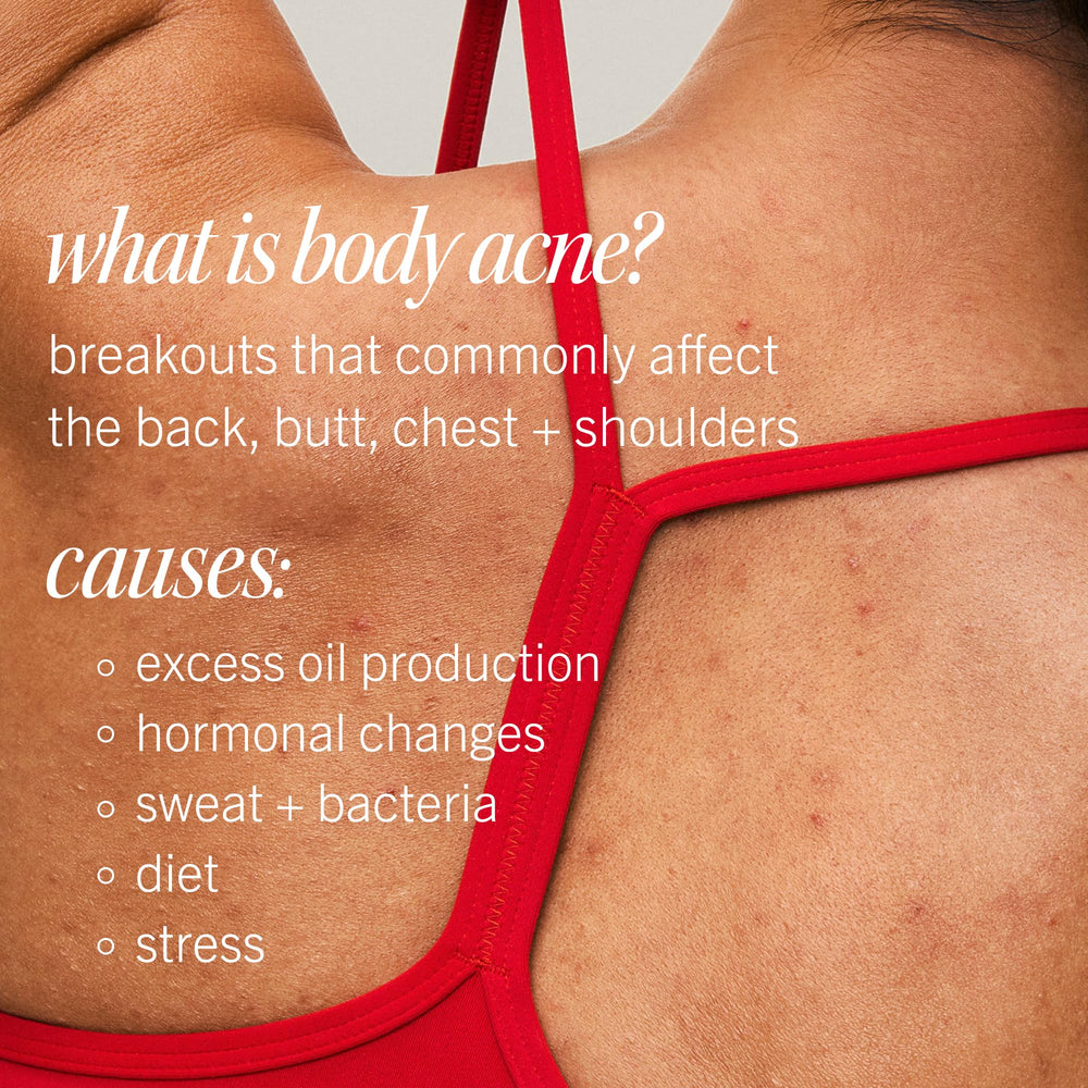 First Aid Beauty Body Acne Spray ideal for post-workout touch-ups.