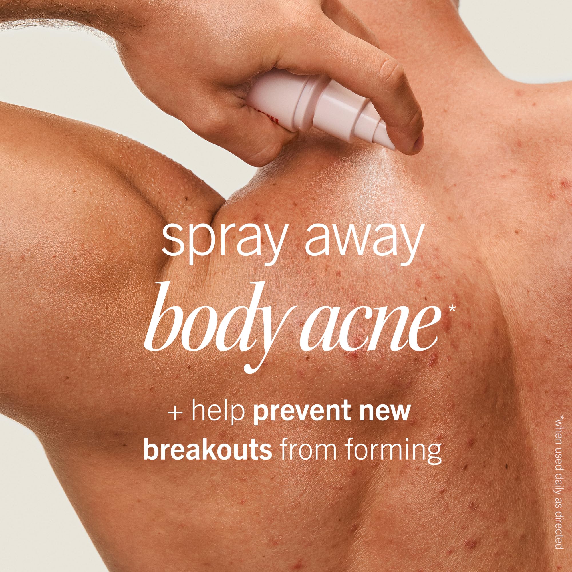 First Aid Beauty Body Acne Spray back-area application helps treat back acne.