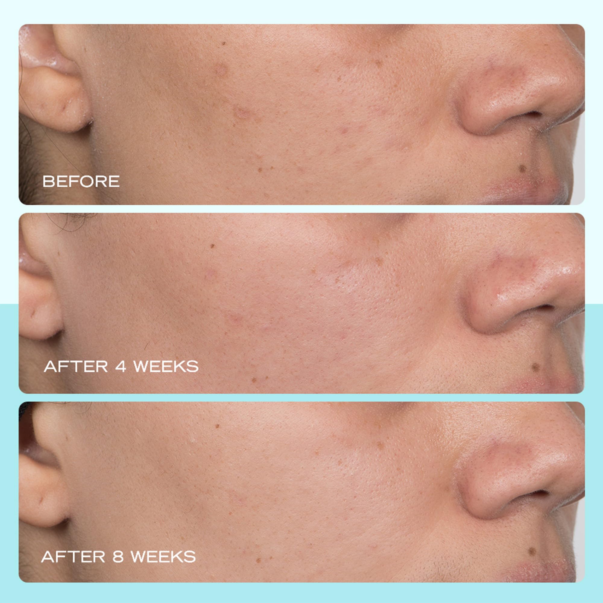 First Aid Beauty application shot demonstrates quick, smooth layering into routine.