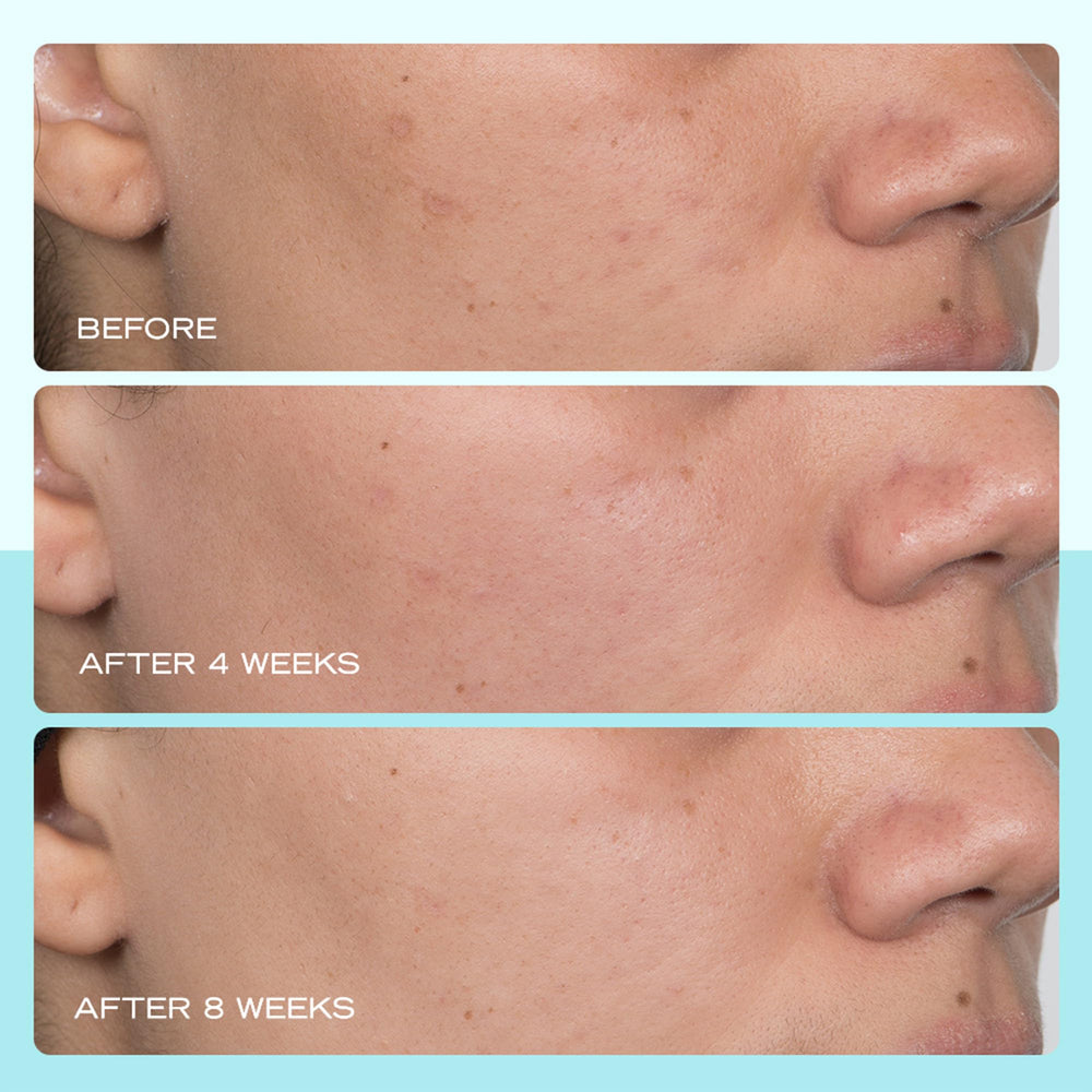 First Aid Beauty application shot demonstrates quick, smooth layering into routine.