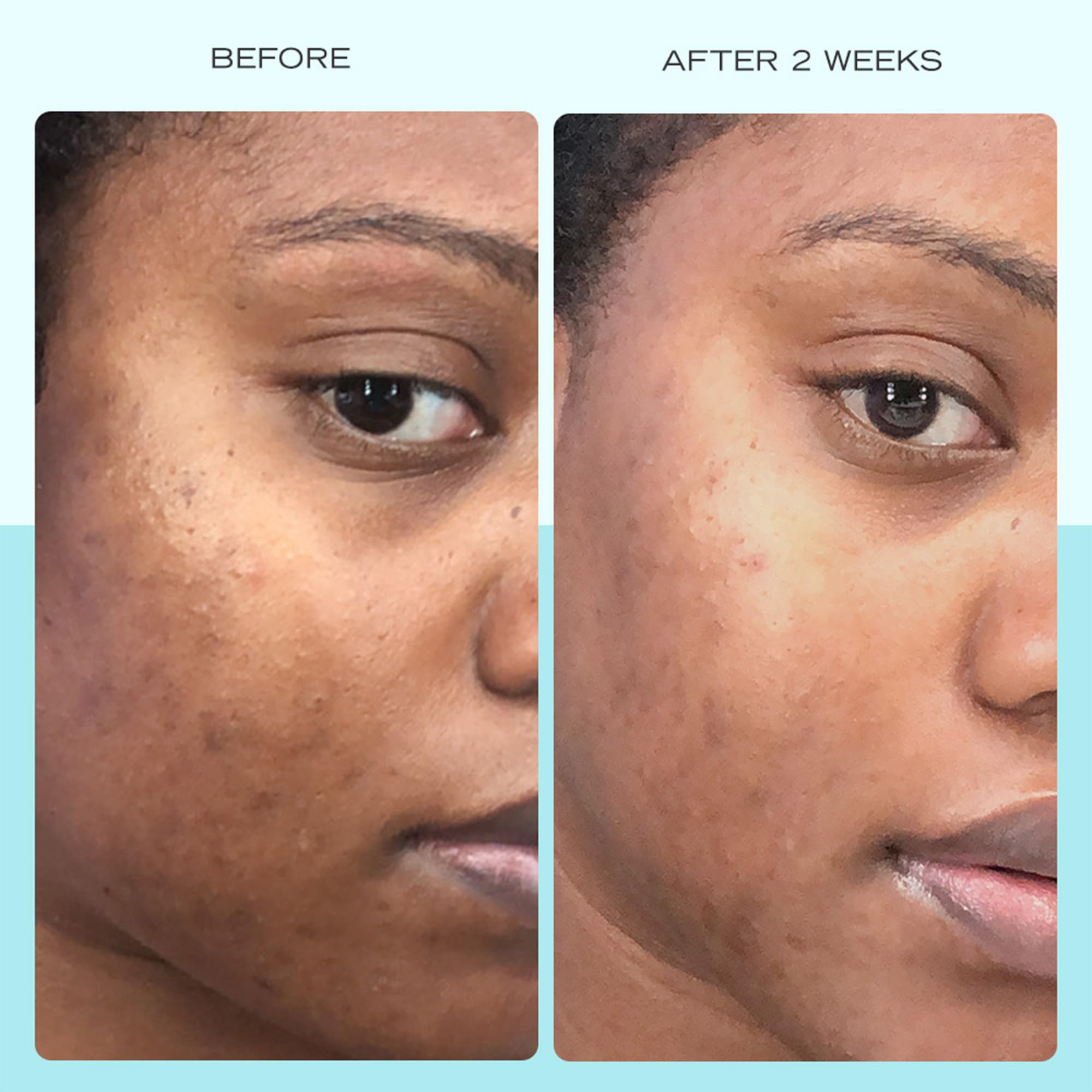 First Aid Beauty serum texture close-up shows lightweight, non-greasy absorption.