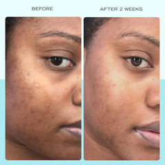 First Aid Beauty serum texture close-up shows lightweight, non-greasy absorption.