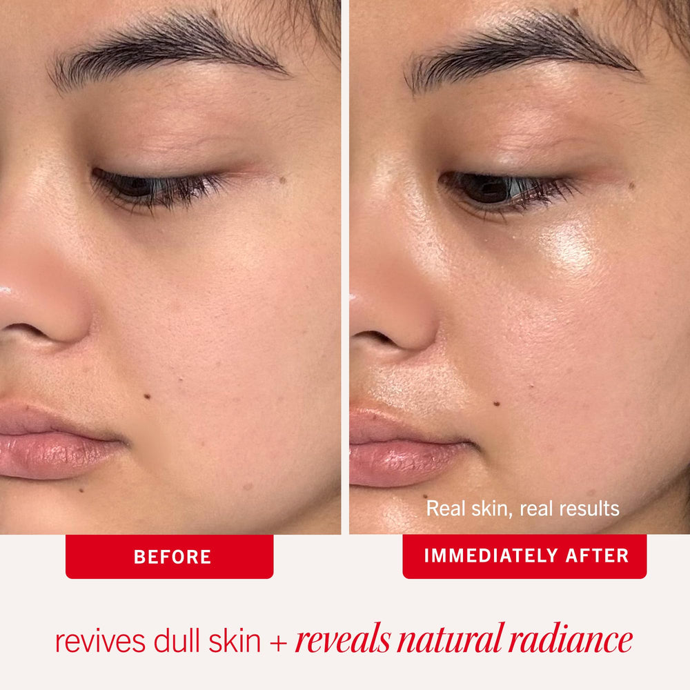 First Aid Beauty exfoliant applied to damp skin to lift dullness