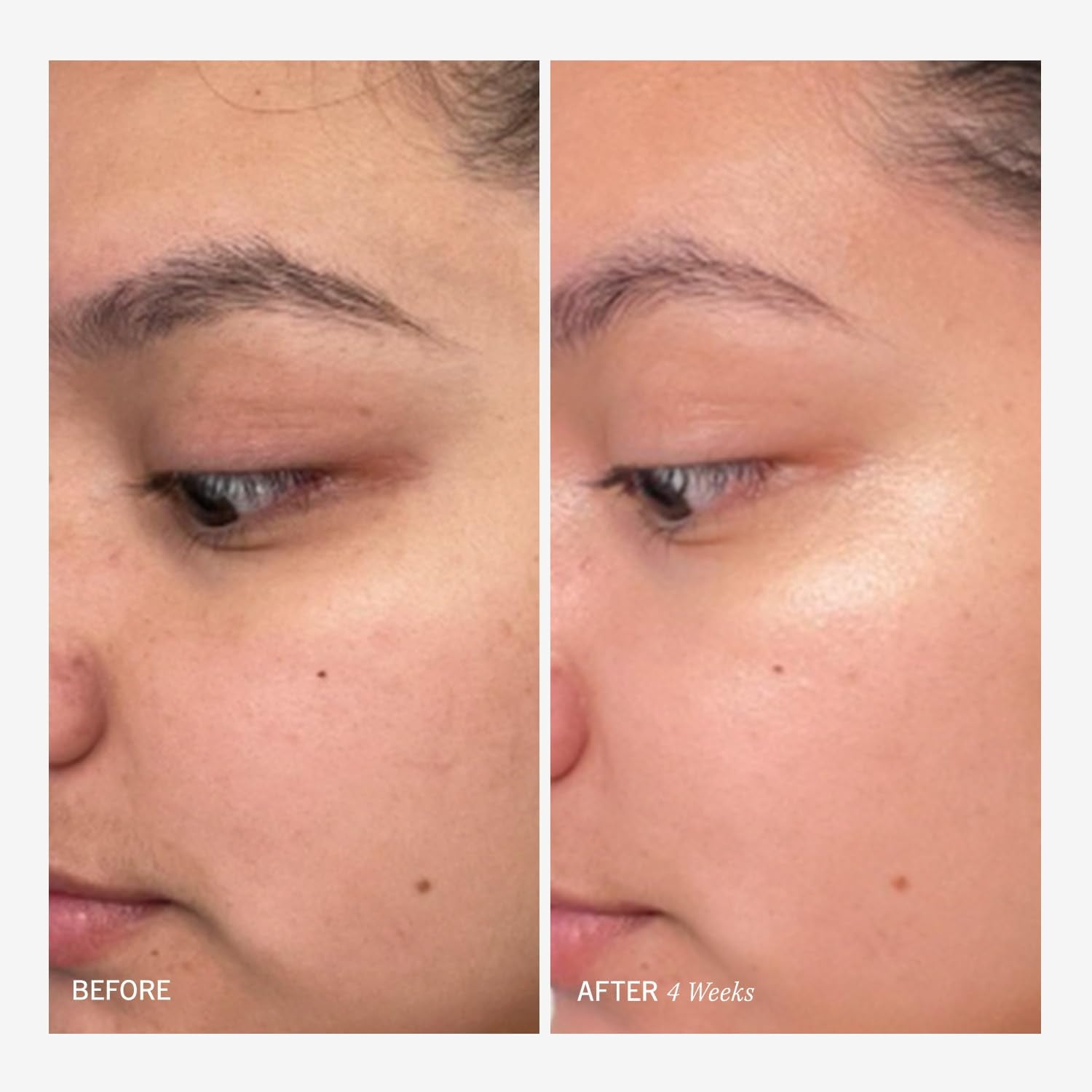 First Aid Beauty facial radiance pads visibly minimize pores around the T-zone.