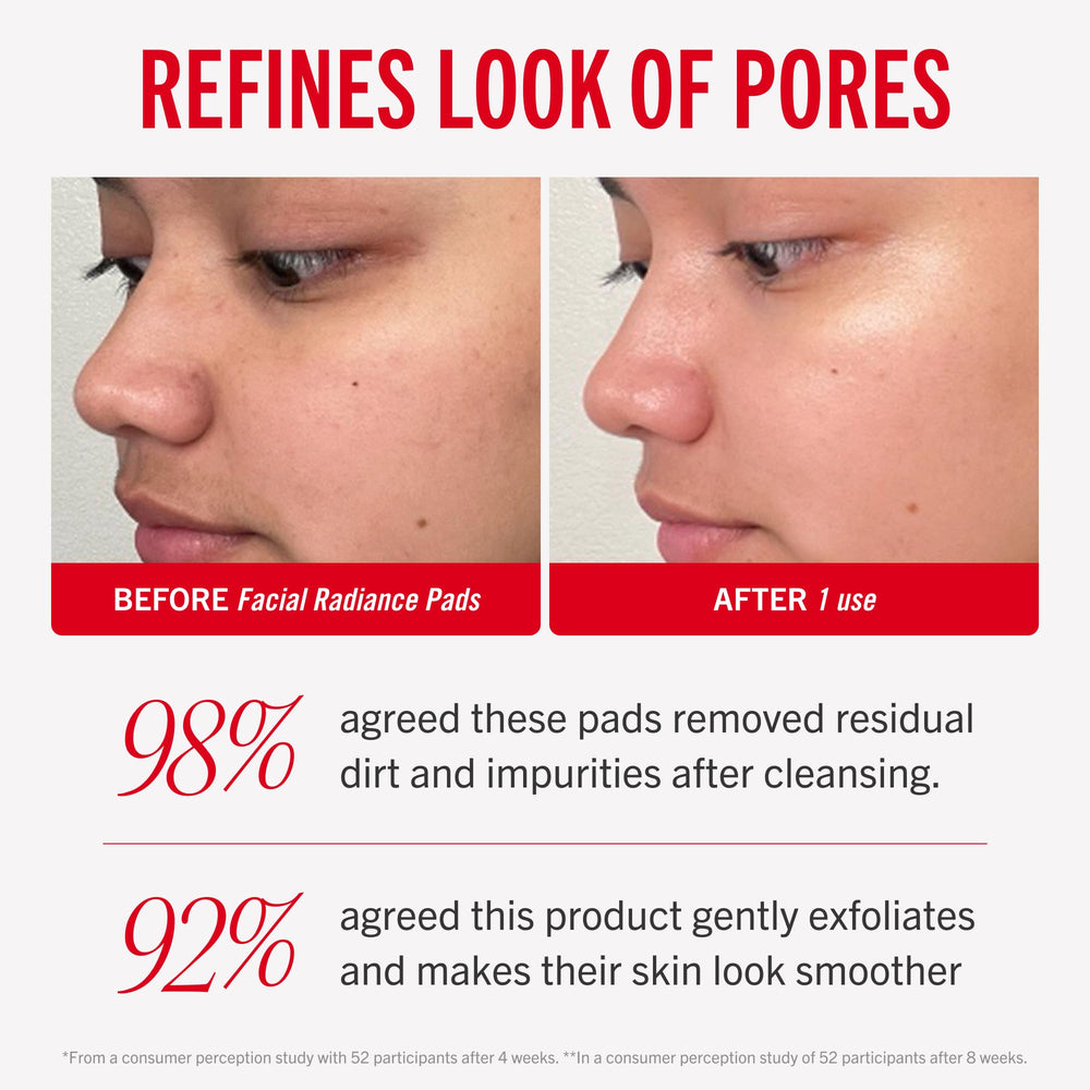 First Aid Beauty facial radiance pads texture closeup highlights gentle exfoliation.
