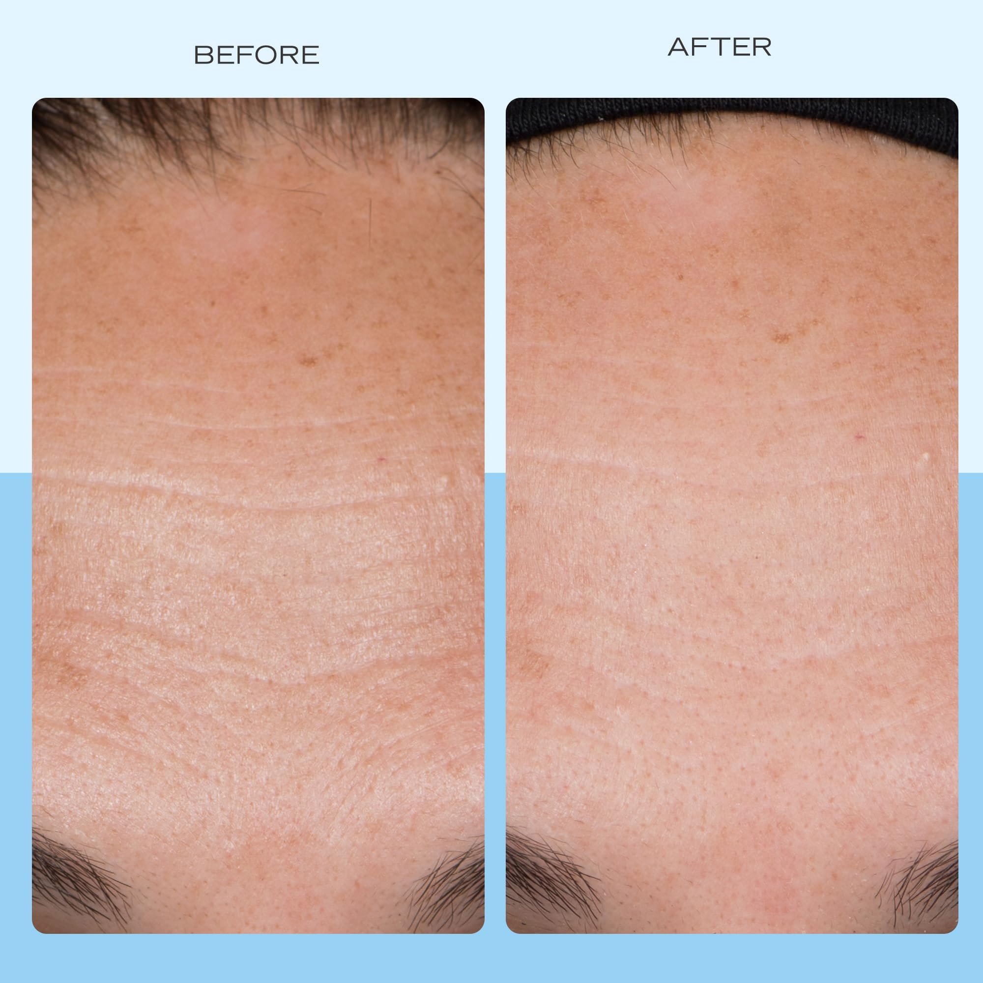 Smoothing cream spread on the face for a plump appearance with First Aid Beauty